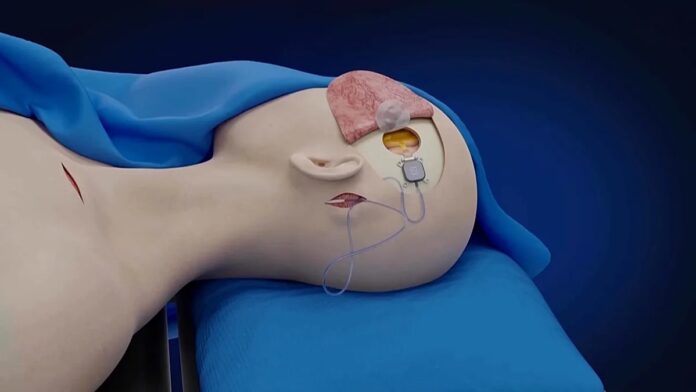 eac917aa-d89f-4983-a84a-a9db33b289b5